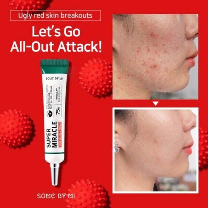 SOME BY MI AHA BHA PHA 14 Days Super Miracle Spot All Kill Cream