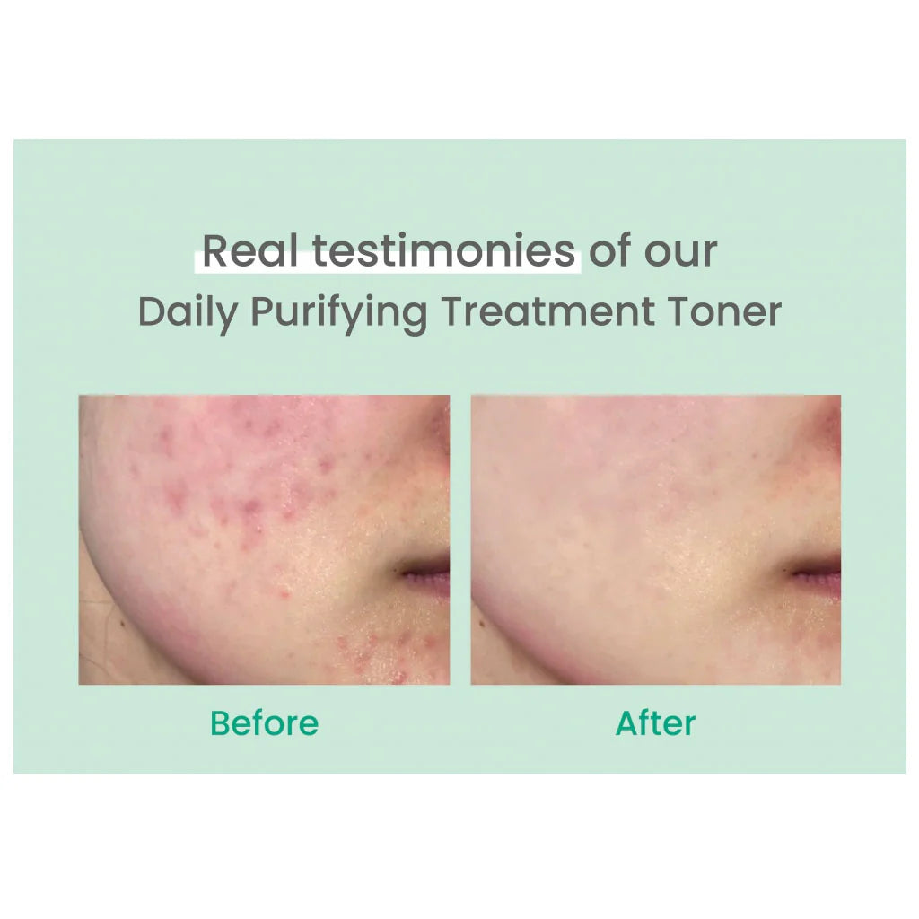 AXIS Y Daily Purifying Treatment Toner