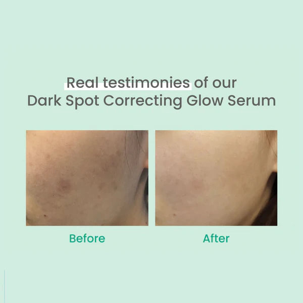 AXIS Y Dark Spot Correcting Glow Serum
