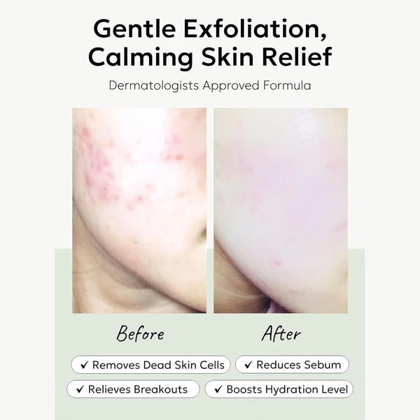 CELIMAX Heartleaf BHA Peeling Pad