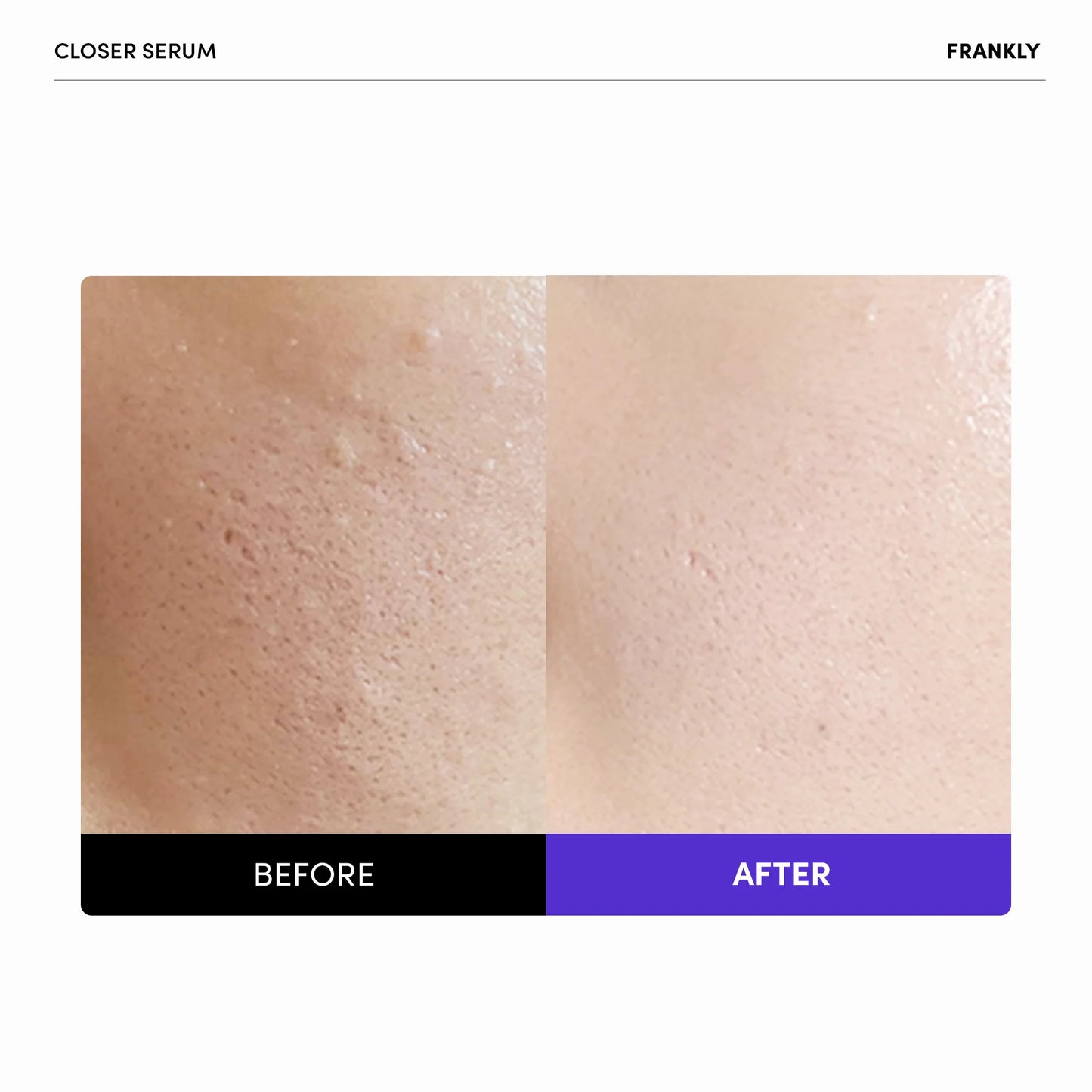 FRANKLY Close Pore Reducing Serum