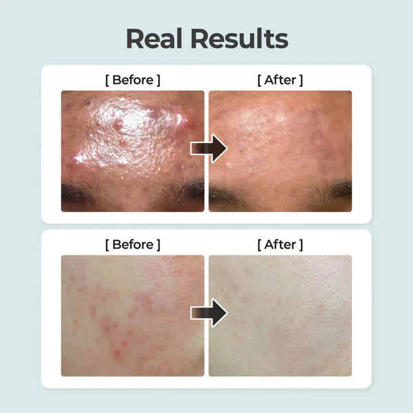 NUMBUZIN No.1 Pure-Full Calming Herb Toner