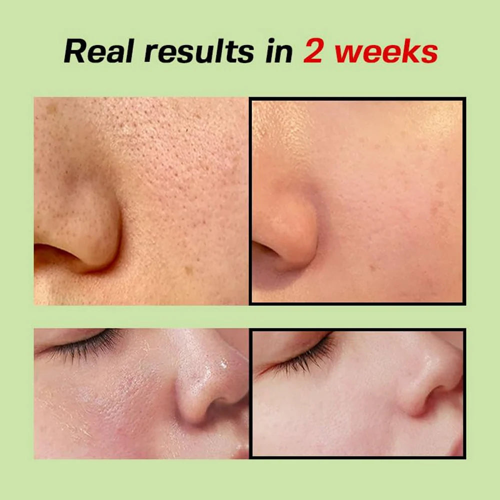 SUNGBOON EDITOR Green Tomato Pore Lifting Ampoule+