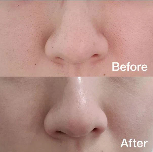 MEDICUBE Zero Pore Pad 2.0