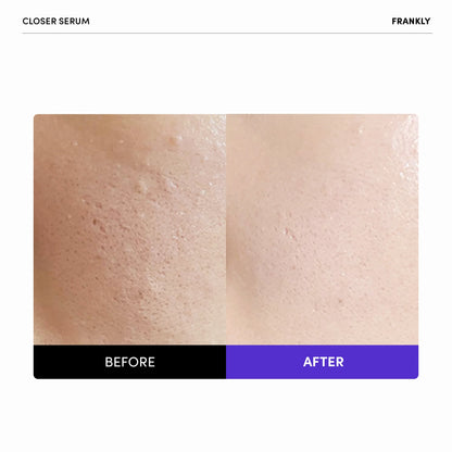 FRANKLY Close Pore Reducing Serum