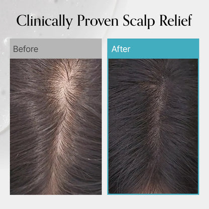 GROWUS Recover Therapy Hair Booster Serum