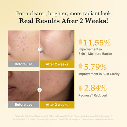 MEDICUBE Kojic Acid Turmeric Niacinamide Serum