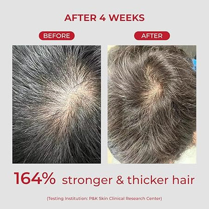 MOEV Annurcatin Shampoo