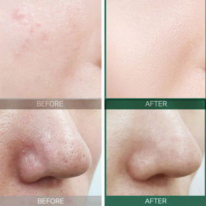 SOME BY MI AHA, BHA, PHA 30 Days Miracle Toner